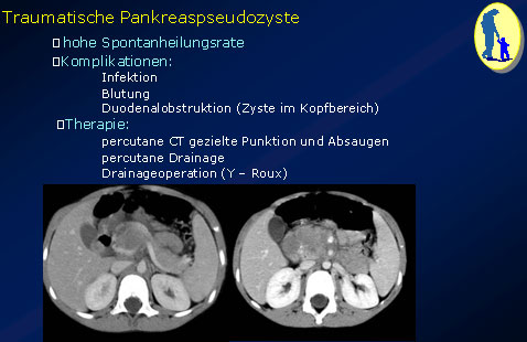 Das stumpfe Bauchtrauma - 03