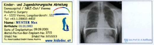 Implantatpass