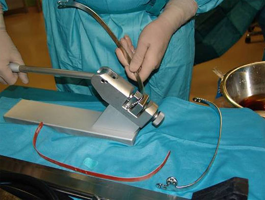 Individuelle Herstellung (Formgebung) der Implantate mit dem speziellen Tischbiegegerät.