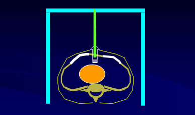 Rochard – Balken – Vorrichtung